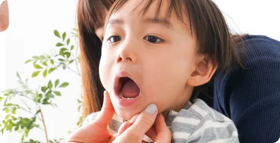 子どものむし歯治療の様子