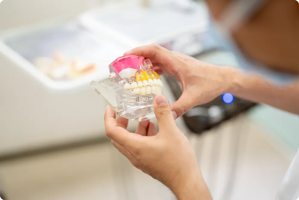 歯の模型を手に持つ歯科医師